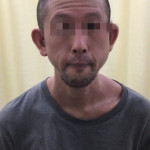 治療開始2ヶ月後